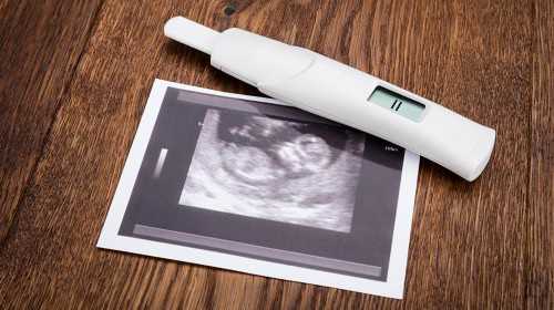 天津哪有代孕女人,【47岁供卵试管的成功率】看见别人刚抱着出生的宝宝出院，